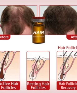 Cvreoz® Hair Regrowth System