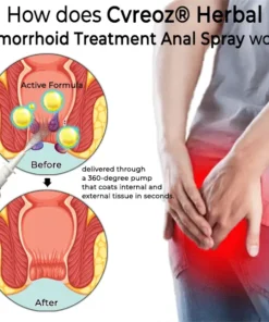 Cvreoz® Herbal Hemorrhoid Treatment Anal Spray Pro