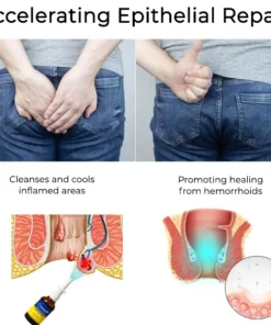 Cvreoz® Herbal Hemorrhoid Treatment Anal Spray Pro
