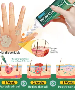 Cvreoz® Knotaway Psoriasis Cream