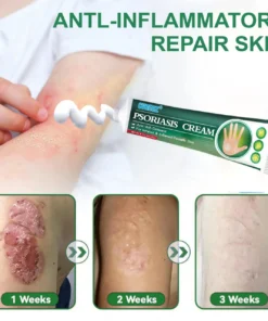 Cvreoz® Knotaway Psoriasis Cream