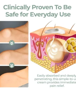 Cvreoz® Lipoma Herbal Relief Cream
