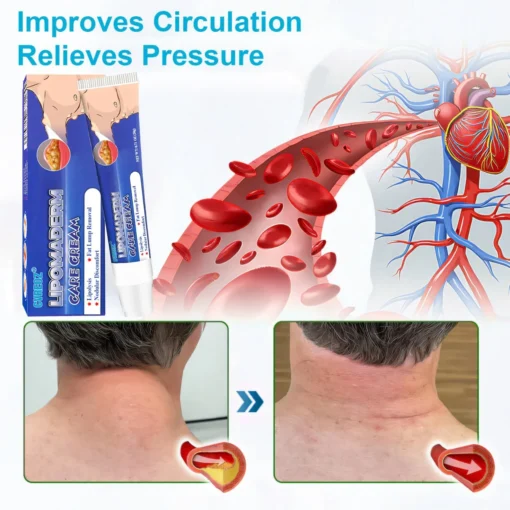 Cvreoz® LipomaDerm Care Cream