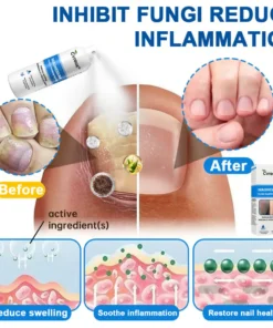 Cvreoz® Magnesium Herbal Psoriasis Spray