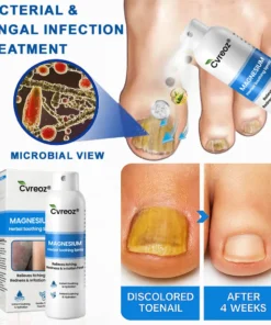 Cvreoz® Magnesium Herbal Psoriasis Spray
