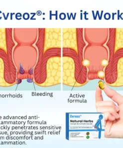 Cvreoz® Natural Herbs Strength Hemorrhoids Capsules