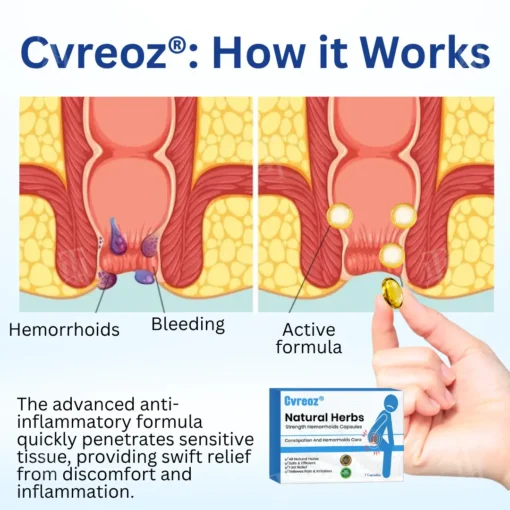Cvreoz® Natural Herbs Strength Hemorrhoids Capsules