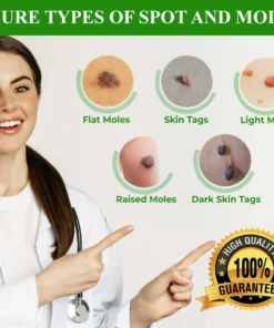 Cvreoz® Natural Spot and Mole removal cream