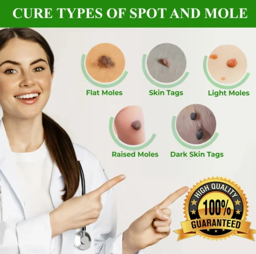 Cvreoz® Natural Spot and Mole removal cream