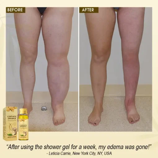 Cvreoz® PRO Lymphatic Drainage Herbal Shower Gel