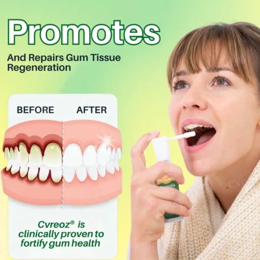 Cvreoz® Propolis Oral Health Spray