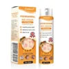 Cvreoz® PsoriaHeal Bee Venom Psoriasis Treatment Spray