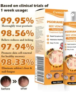 Cvreoz® PsoriaHeal Bee Venom Psoriasis Treatment Spray