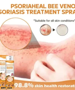 Cvreoz® PsoriaHeal Bee Venom Psoriasis Treatment Spray