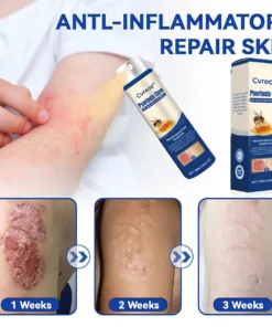 Cvreoz® Psoriasis Cure Bee Venom Treatment Spray