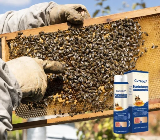 Cvreoz® Psoriasis Cure Bee Venom Treatment Spray