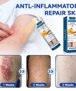 Cvreoz® Psoriasis Heal Bee Venom Spray
