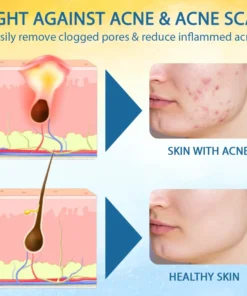 Cvreoz® PsoriasisCare Mellifera Venom Skin Healing Spray