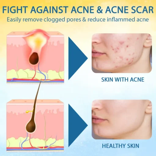 Cvreoz® PsoriasisCare Mellifera Venom Skin Healing Spray