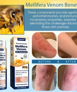 Cvreoz® PsoriasisCare Mellifera Venom Skin Healing Spray
