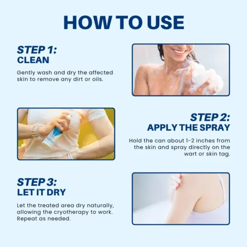 Cvreoz® TagRecede Cryo Treatment Spray