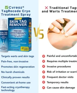 Cvreoz® TagRecede Cryo Treatment Spray