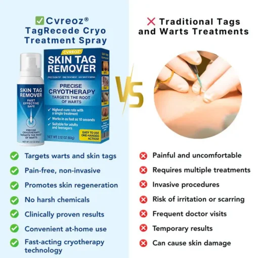 Cvreoz® TagRecede Cryo Treatment Spray