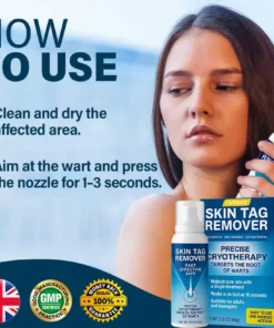 Cvreoz® TagRecede Cryo Treatment Spray