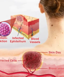 Cvreoz®MicroNeedle BotanicSkin Tag Removal Patch