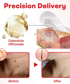 Cvreoz®MicroNeedle BotanicSkin Tag Removal Patch