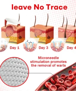 Cvreoz®MicroNeedle BotanicSkin Tag Removal Patch