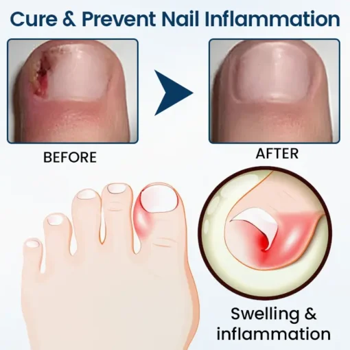 Cvreoz®OnyxiGuard Fungal Repair Herbal Spray