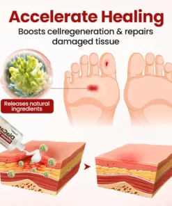 CVREOZ® DiaCare Diabetic Treatment Cream