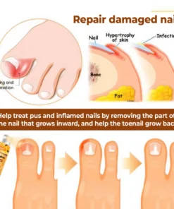 Crveoz® Bee Venom Nail Fungus Herbal Spray