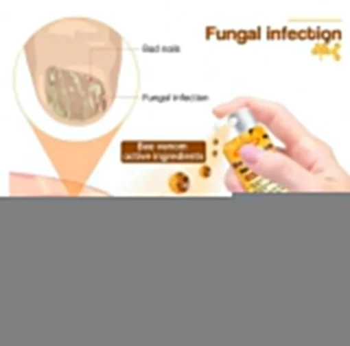 Crveoz® Bee Venom Nail Fungus Herbal Spray