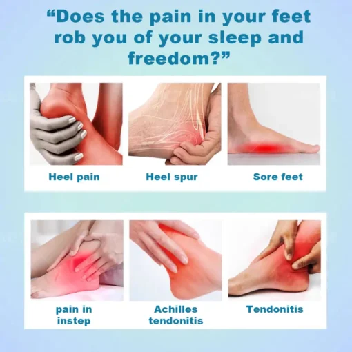 Cvreoz® ADVANCED FOOT PAIN RELIEF CREAM