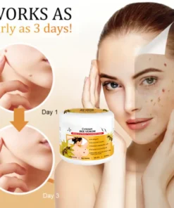Cvreoz® Bee Venom Mole and Wart Treatment Cream