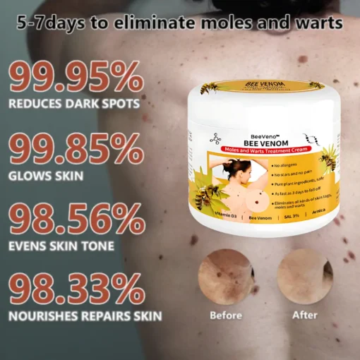 Cvreoz® Bee Venom Mole and Wart Treatment Cream