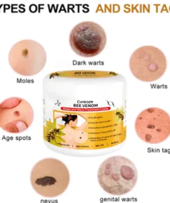 Cvreoz® Bee Venom Mole and Wart Treatment Cream