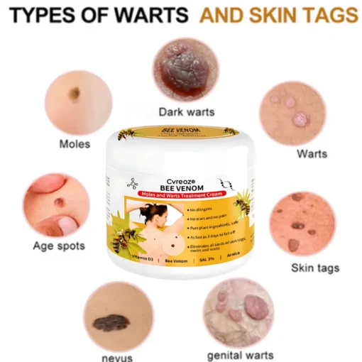Cvreoz® Bee Venom Mole and Wart Treatment Cream
