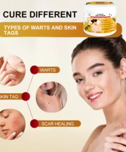 Cvreoz® Bee Venom Mole and Wart Treatment Cream