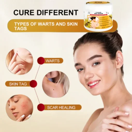 Cvreoz® Bee Venom Mole and Wart Treatment Cream