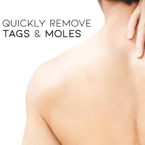 Cvreoz® Bee Venom Mole and Wart Treatment Cream