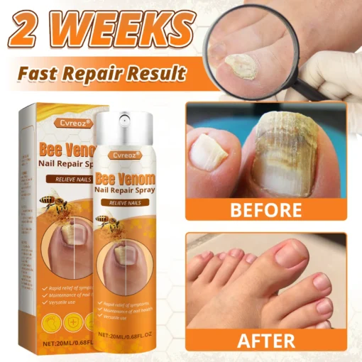Cvreoz® Bee Venom Nail Repair Spray