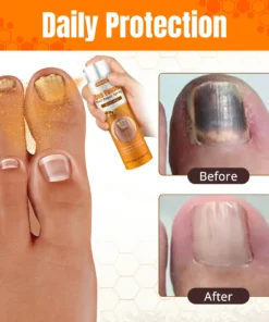 Cvreoz® Bee Venom Nail Repair Spray