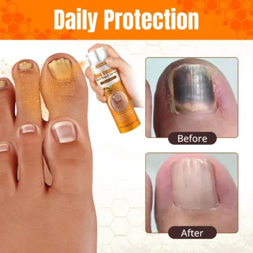 Cvreoz® Bee Venom Nail Repair Spray