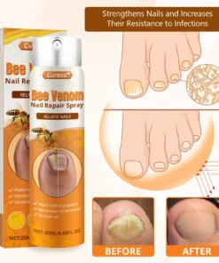 Cvreoz® Bee Venom Nail Repair Spray