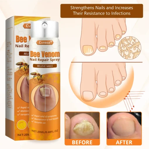 Cvreoz® Bee Venom Nail Repair Spray