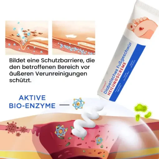 Cvreoz® Diabetisches Fußgeschwür Heilungscreme
