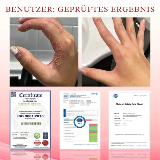 Cvreoz® GlucoseGuard Haut-Rettungs-Creme